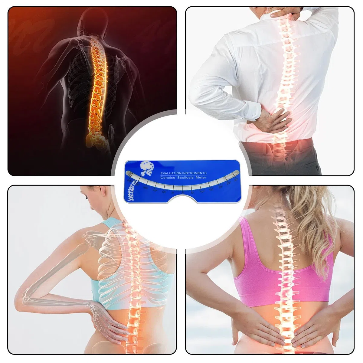 Regla de medición de escoliosis - Medidor de escoliosis, herramienta de medición reutilizable fácil de usar | Medidor de prueba de precisión de 0 a 30 grados | Medidor de prueba de escoliosis portátil